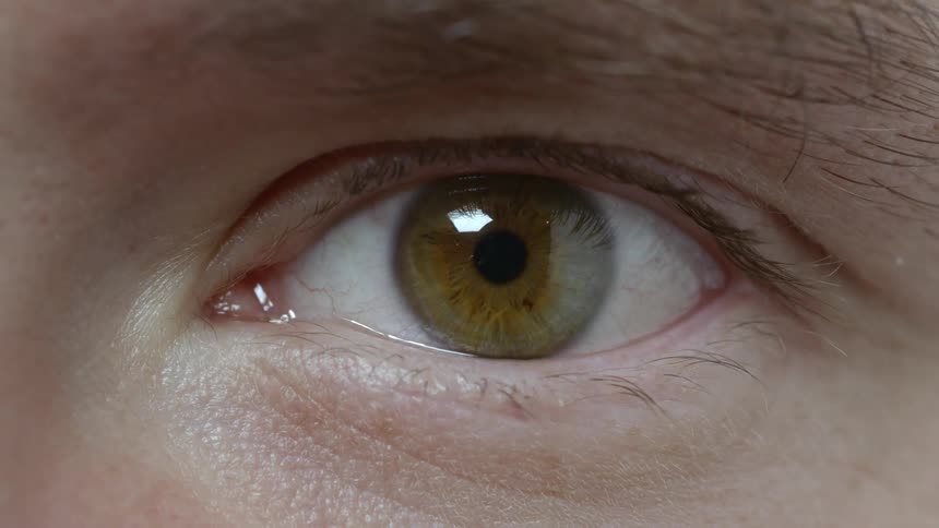 A white person opening their eyes to look into the camera