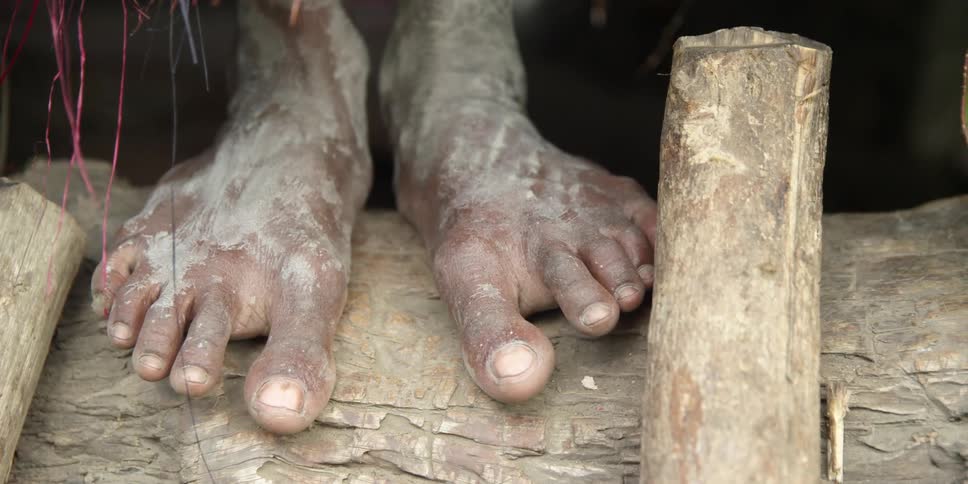 Dirty feet are shown