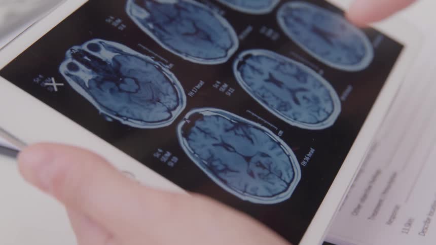 A person scrolls through medical images on a tablet screen