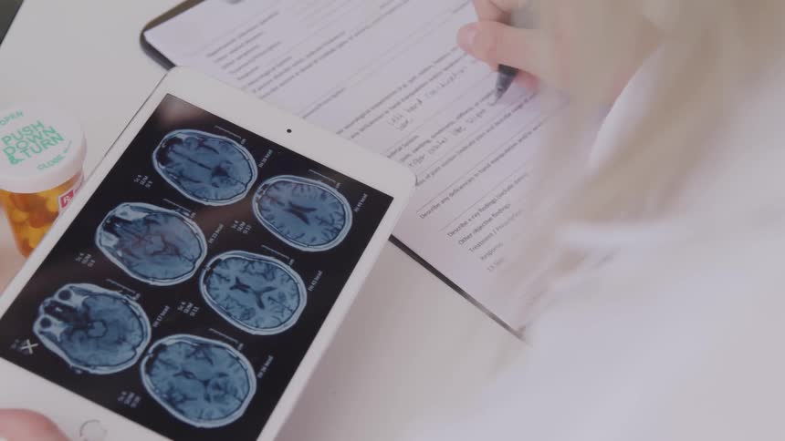 A doctor looks at brain scan images on a tablet while writing on a paper