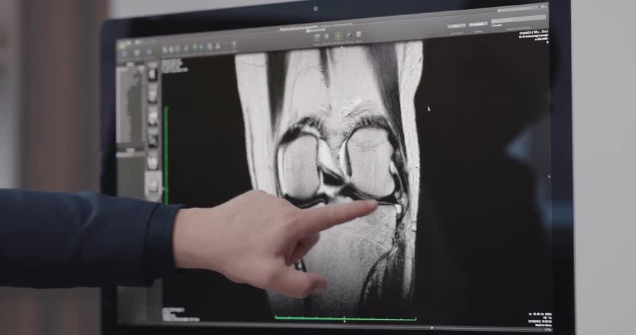 A person is looking at an xray at the doctors office