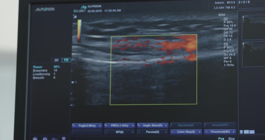 A person points out something on a medical image