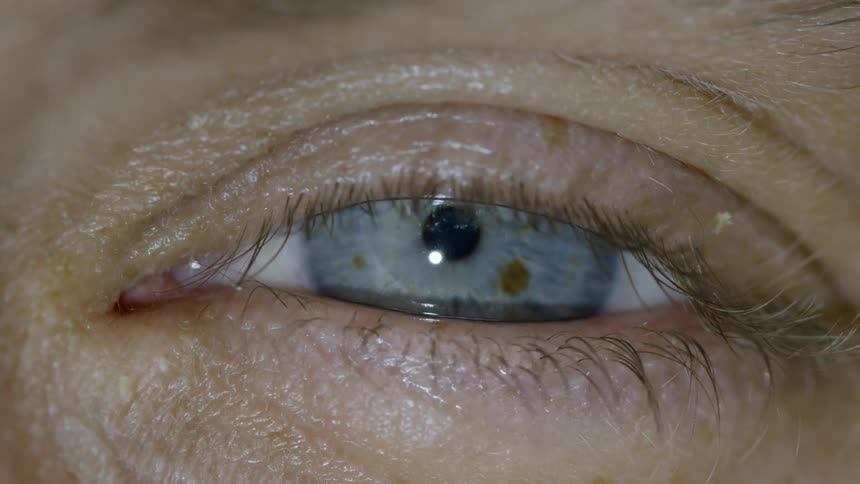 Close up view of a persons eye