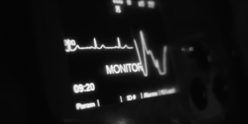 An electrocardiogram shows a patients heart rate