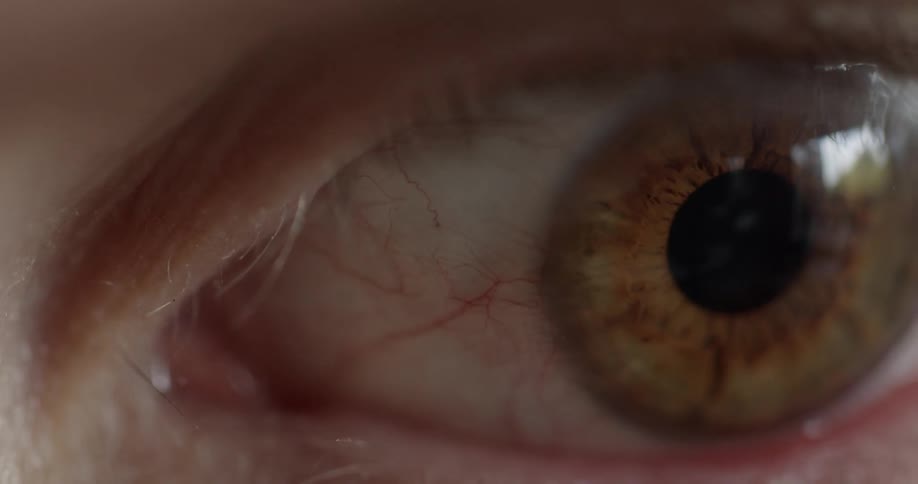 Brown eye moving around