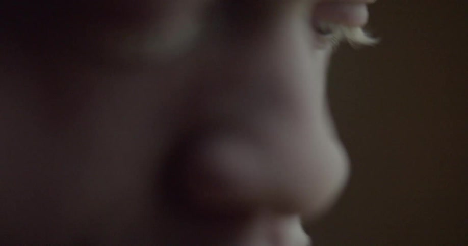The face and light colored eye lashes of a man with albinism