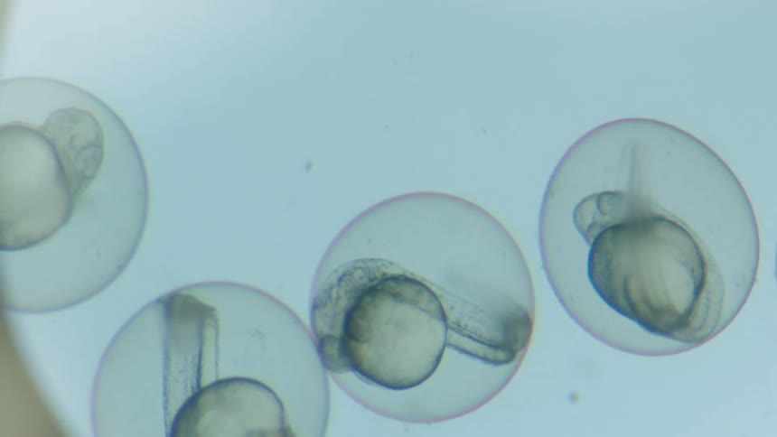 Specimens on a slide on a microscope