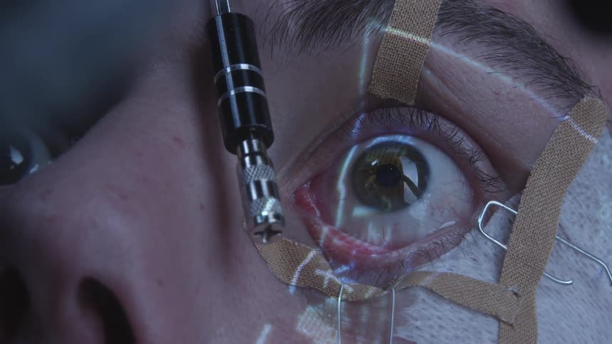 A person with chinese characters being projected onto their eye tries to blink as a tool is placed before the eye but is prevented by tape holding the eyelid open