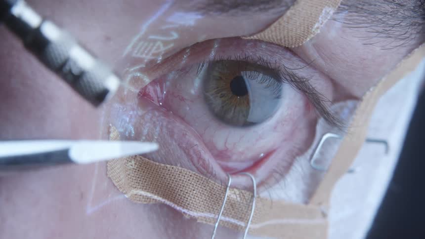 A man is having his eye examined