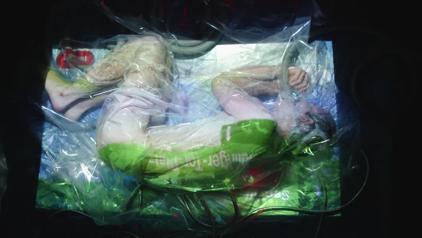 A person laying down with a mask on covered in plastic with lights projected on them