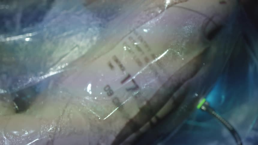 A persons body part is wrapped in plastic with text reflecting on it