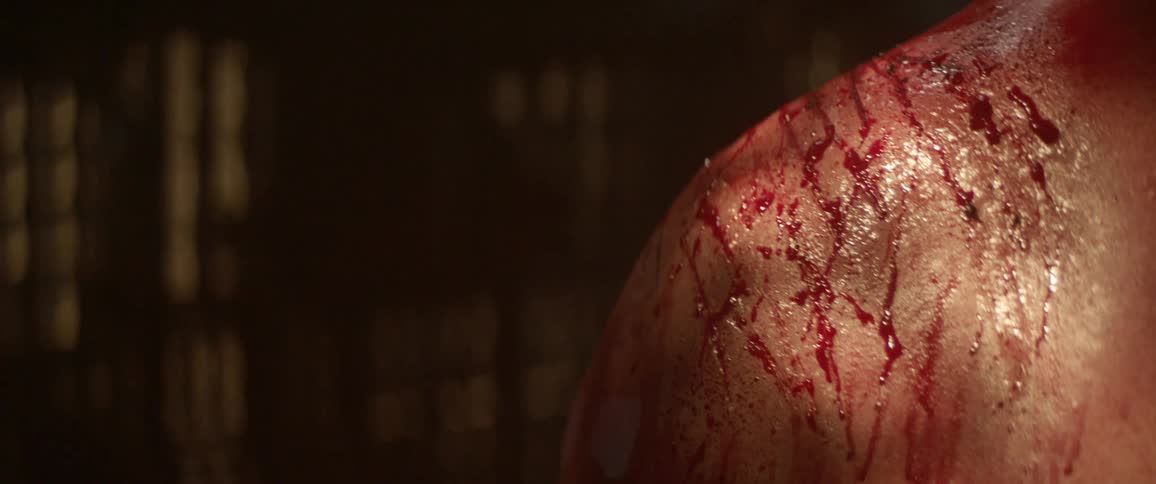 A white mans shoulder covered in wounds and blood