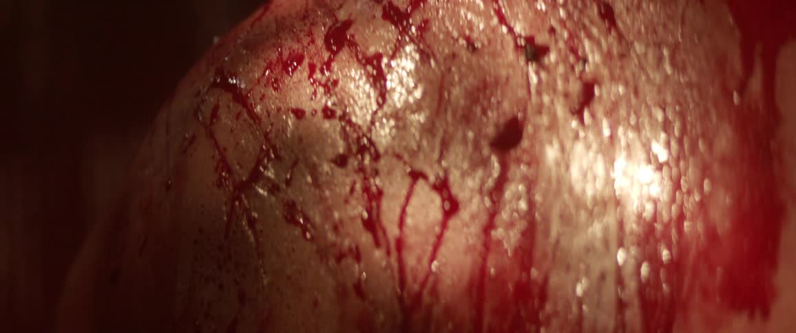 The back of a person covered in blood