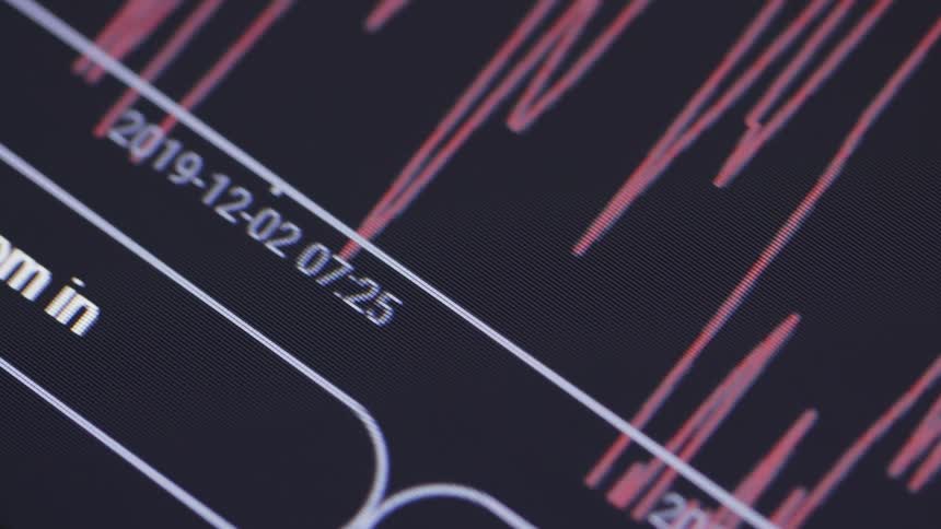 A medical device display screen with dates and times and a graph chart
