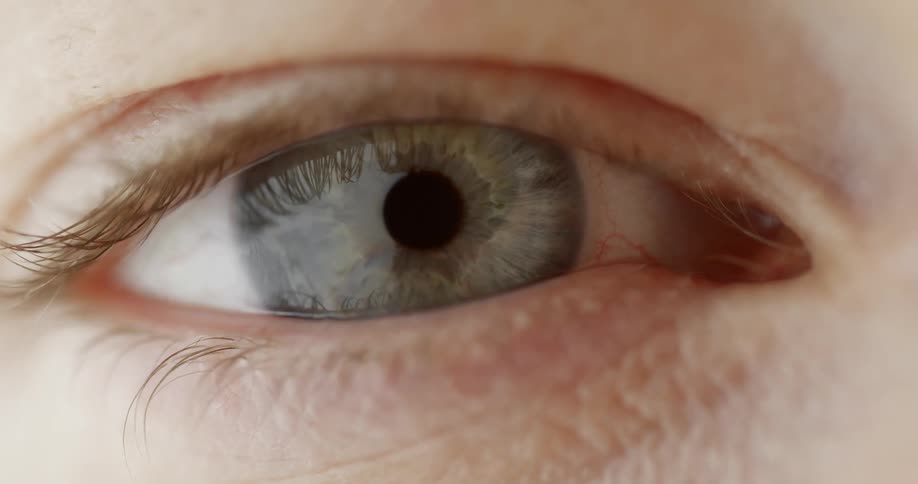 Persons pupil contracts as person opens eye