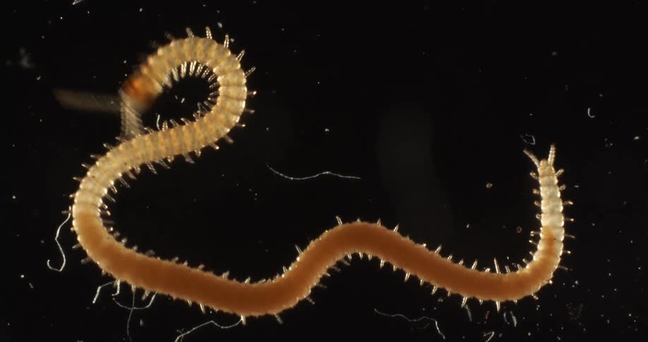 A long worm wiggles when examined under a microscope