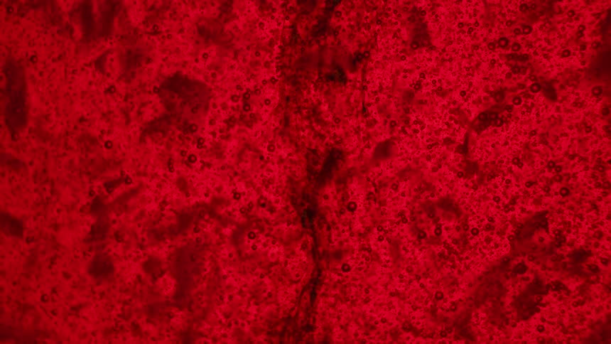 A crimson red spongy texture
