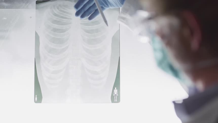 A doctor explains the results of a chest x ray hanging from a lighted white board