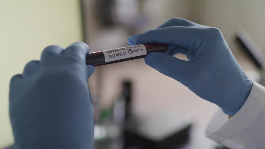 A nurse holds a test tube with a specimen in it