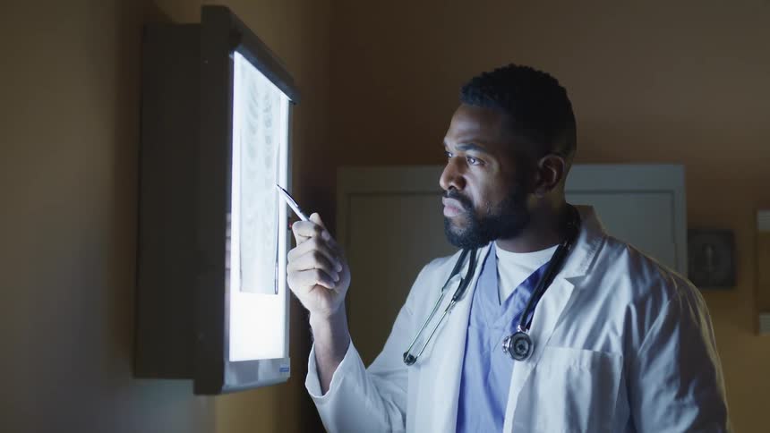Doctor stands studying x ray in x ray viewer box