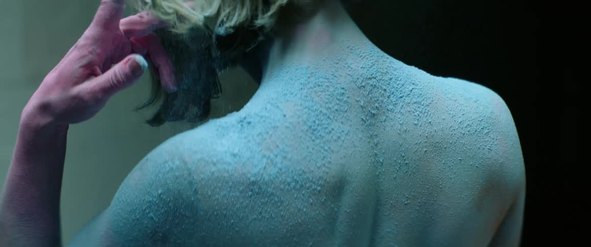 A woman flicks her hair in the shower as she stands with her back covered in a blue scrub and her arm bright red