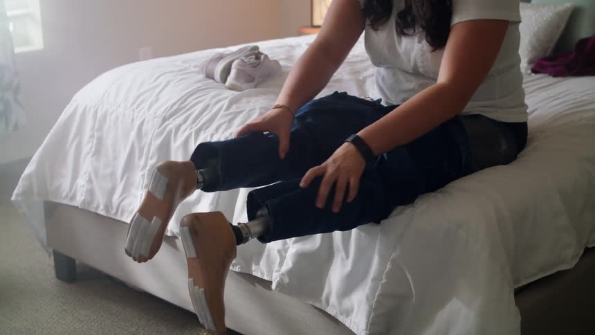 Woman sitting on bed adjust pants over artificial limbs