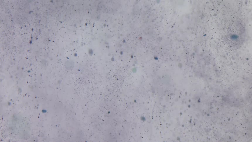 Movement of blue particles suspended in liquid