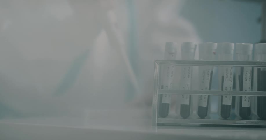Lab technician prepare blood tests in a lab
