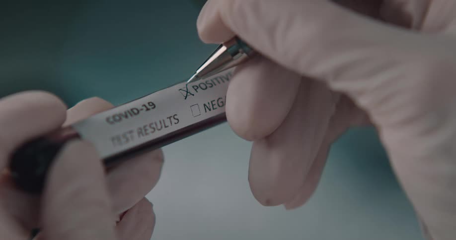 Vial of blood being marked positive for coronavirus