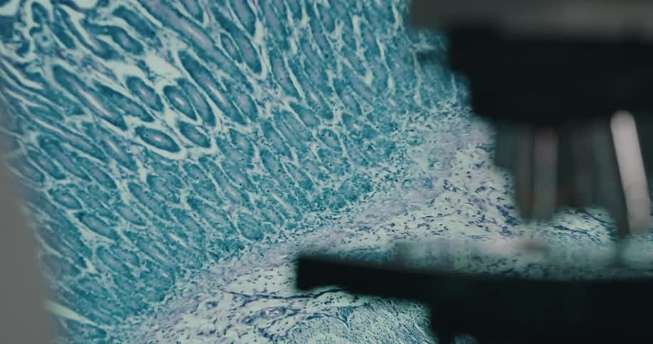 A slide with cells on a microscope is magnified on to a screen
