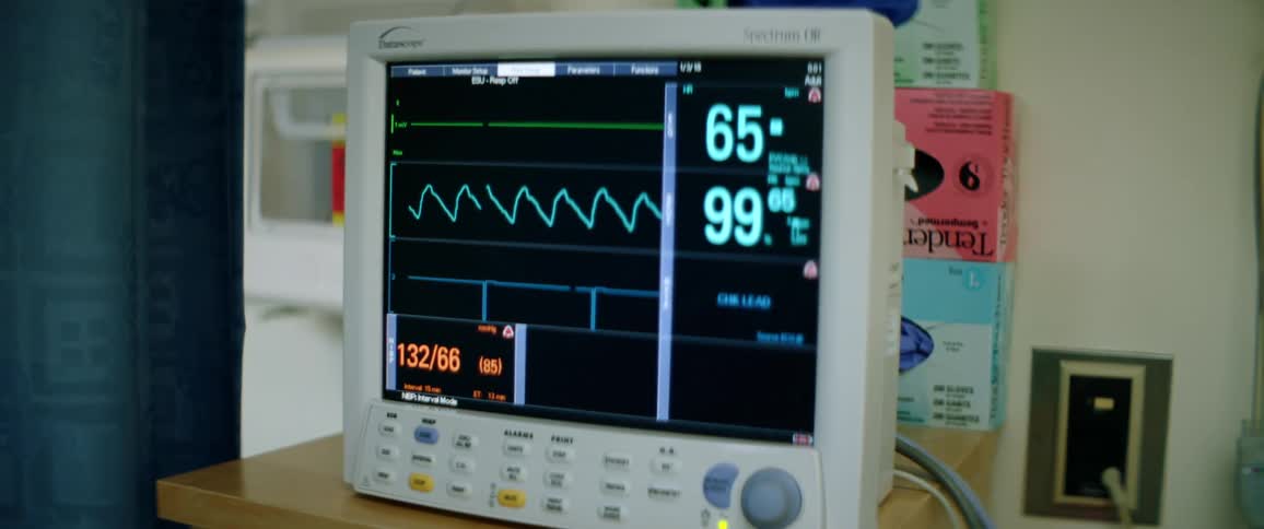 A vital signs monitor in a hospital room