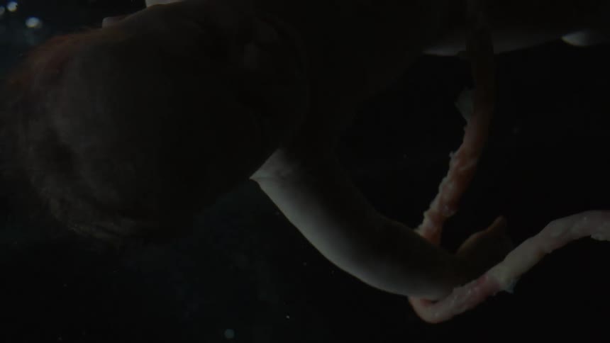 Unborn babys head and umbilical cord in the water
