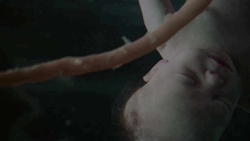 A fetus and umbilical cord floating in liquid