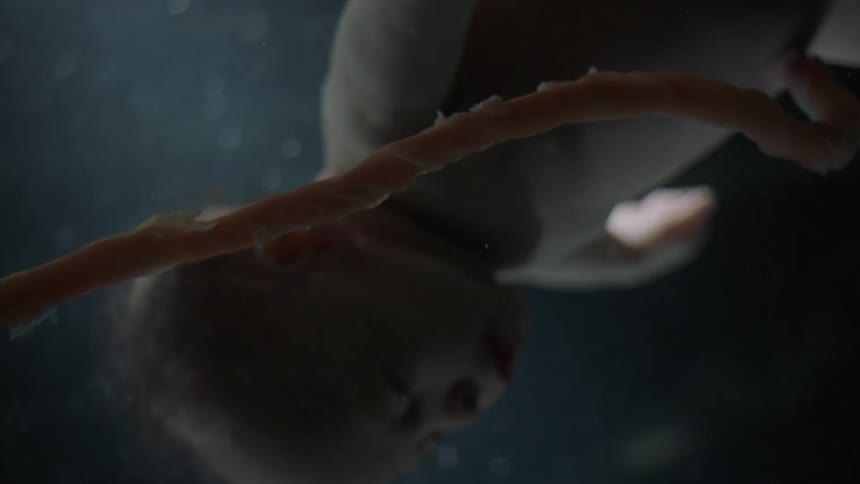 A fetus and umbilical cord floating in utero