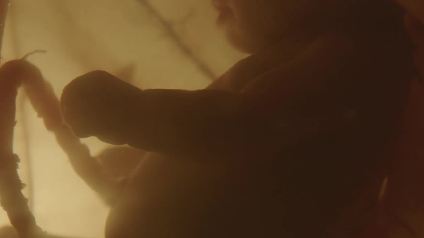 Unborn babys umbilical cord and arms in the womb
