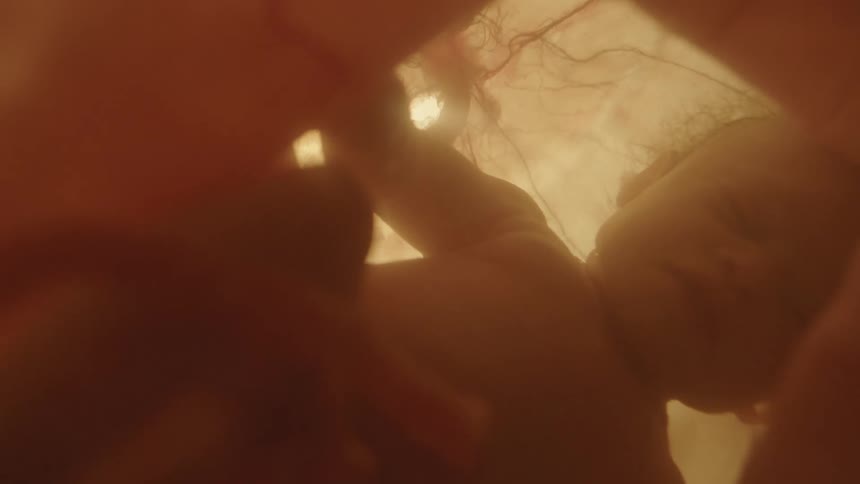 A fully developed fetus rests inside of a uterus filled with amniotic fluid