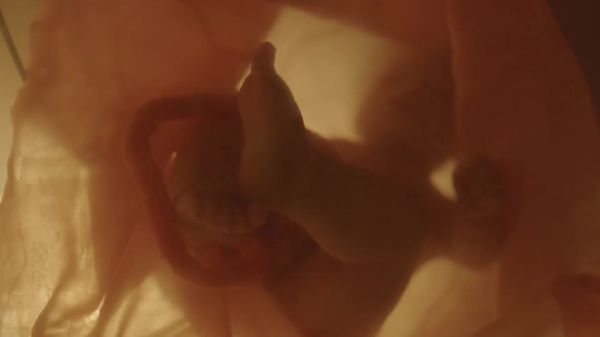 Baby floats in womb looks very comfy