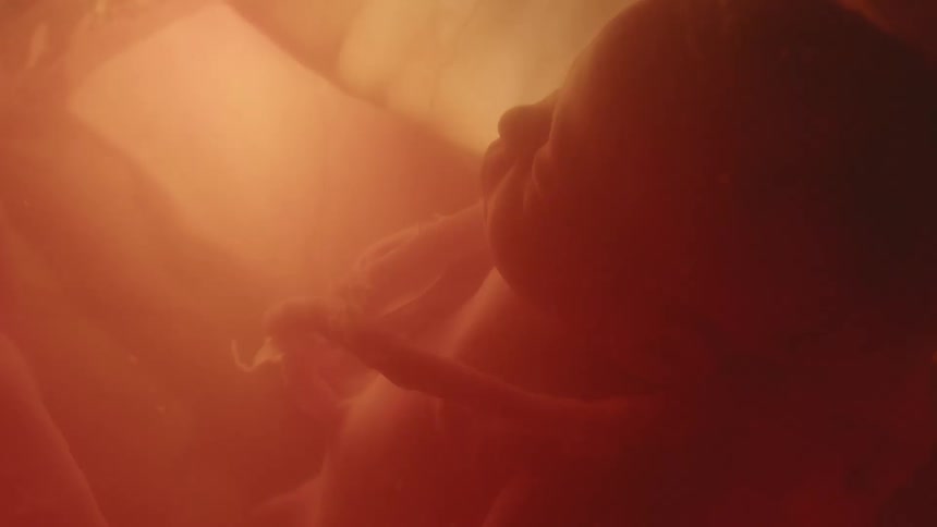 Unborn baby with the cord wrapping around the babys neck in the womb