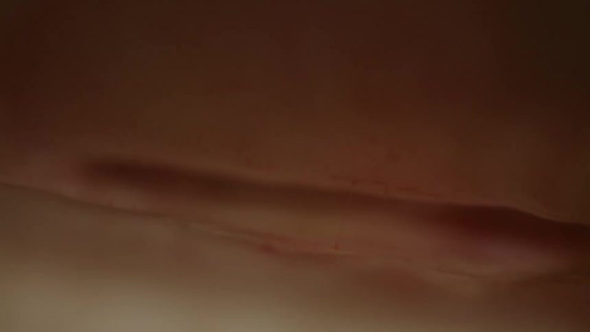 Close up of a fleshy surface