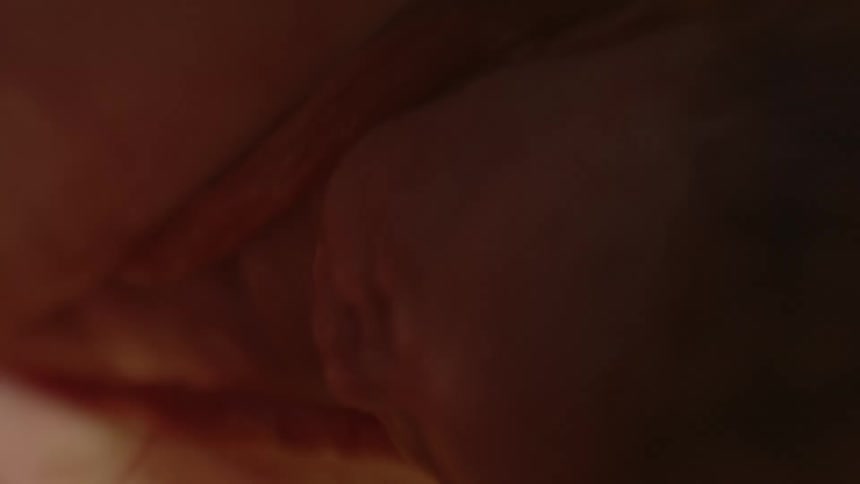Unborn babys head in the womb