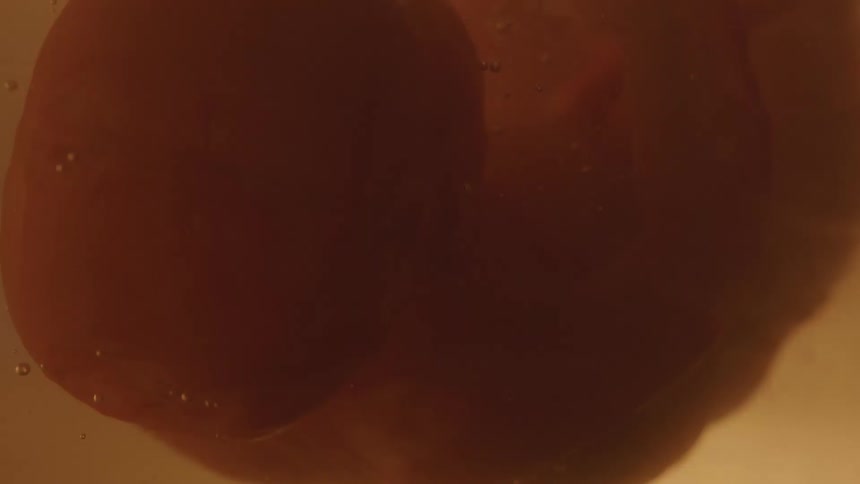 A fetus is shown in a mothers uterus
