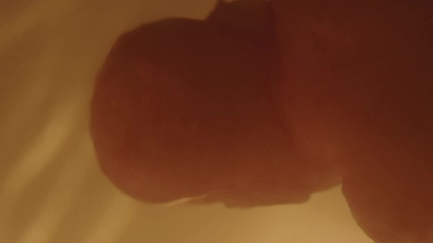 Developing baby floating in the amniotic sac in utero
