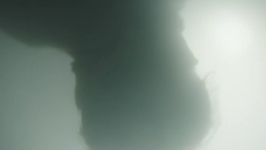 Unborn baby turns in fluid silhouetted by light
