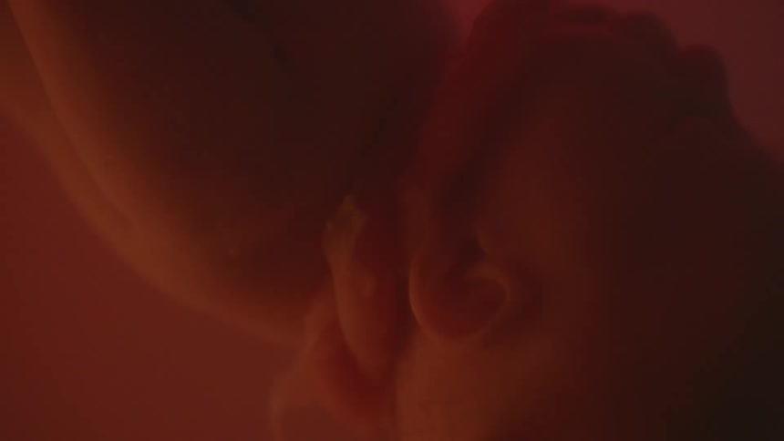 A fetus floating in a uterus has its umbilical cord wrapped around its neck