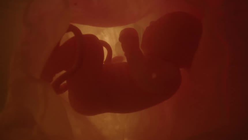 A fetus floating in utero