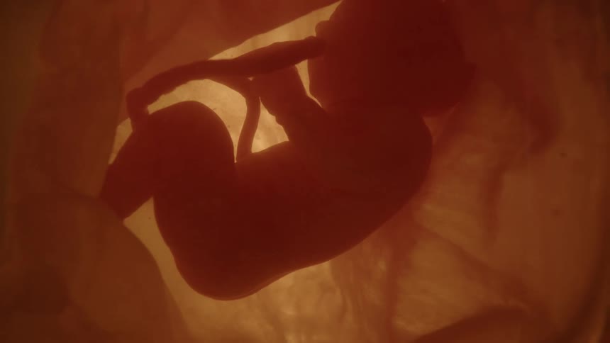A fetus floating in a uterus