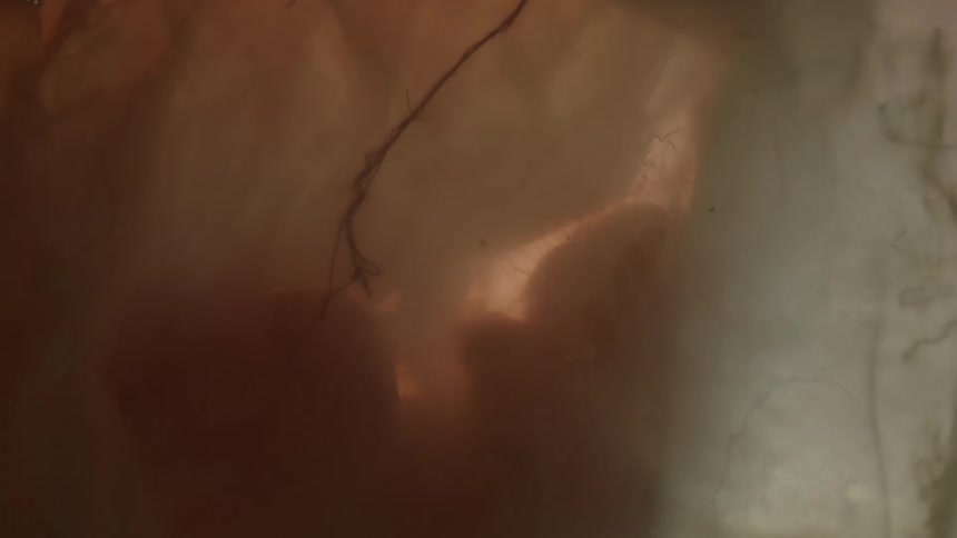 Unborn baby in the womb