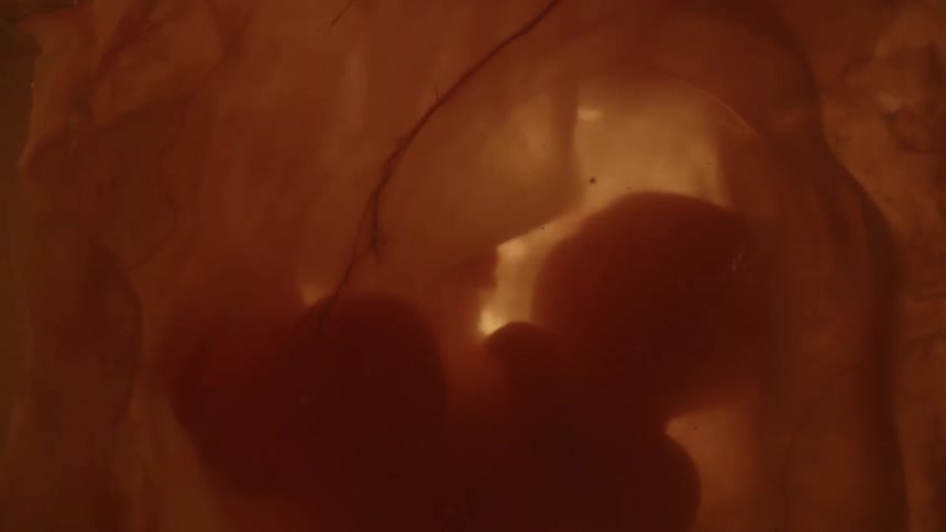 Baby floats in amniotic fluid with umbilical cord attached
