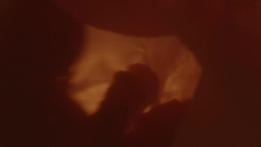Unborn baby is arms and face are silhouetted in the womb