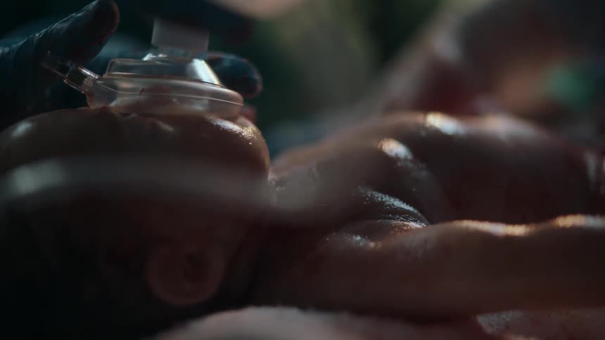 Doctor stimulates newborn human baby to breath using hands and oxygen face mask after delivery in a hospital